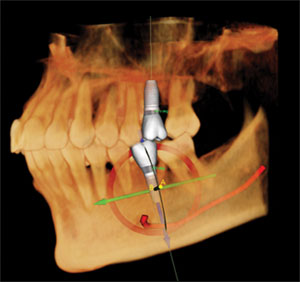 3D Dental image CT Scan